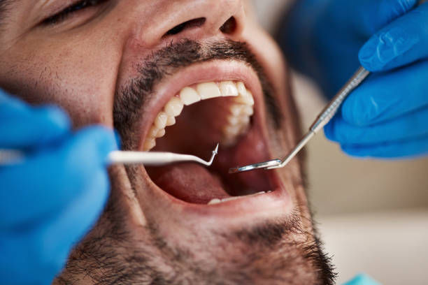 Best Emergency Dentist for Lost Fillings or Crowns in Pine Knoll Shores, NC